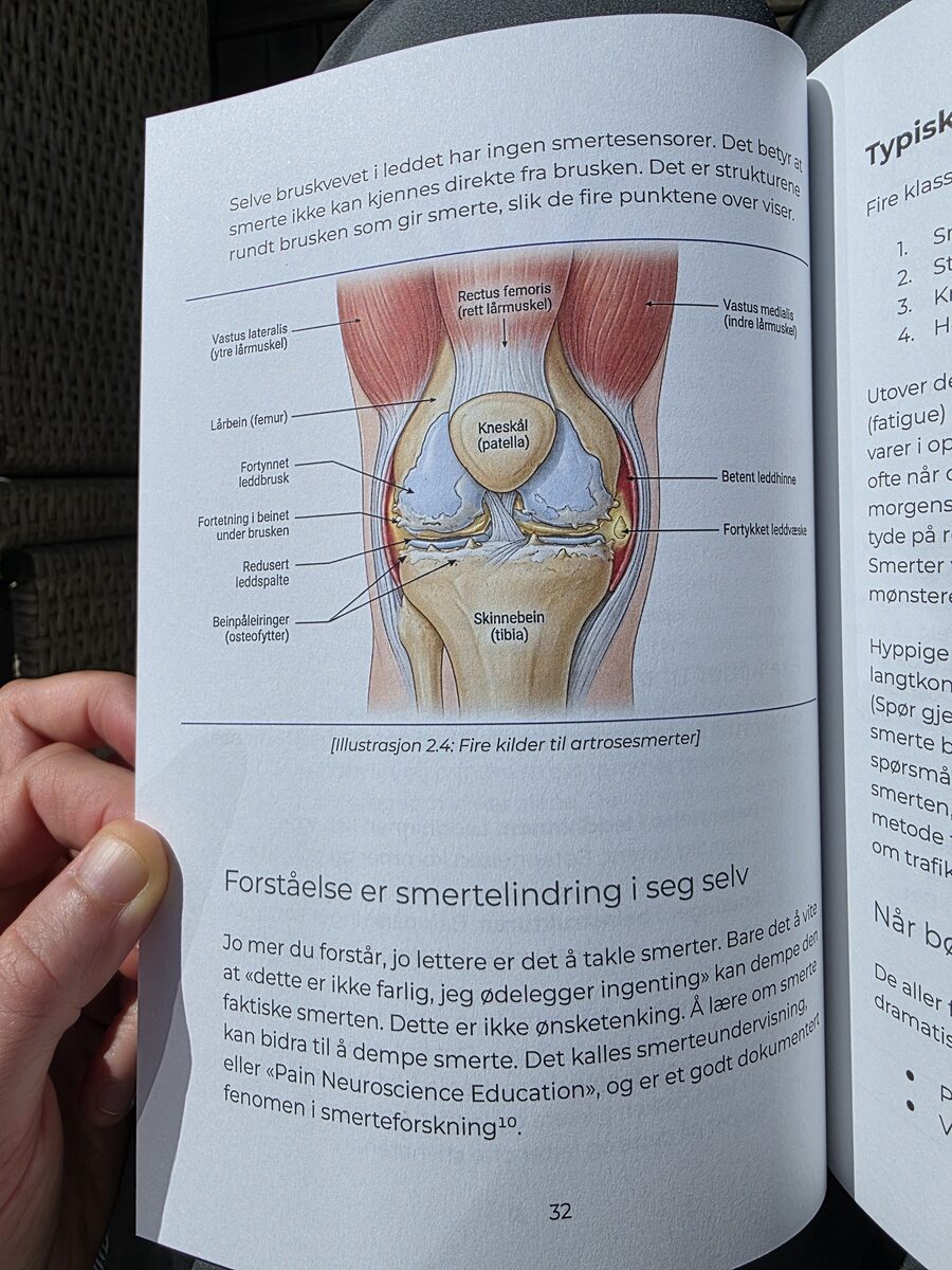 Oppslag fra boken: illustrasjon av kneleddet med brusk, leddhinne og muskler